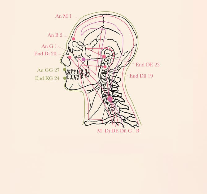 Anatomische Übersicht des traditionellen APM-Modells mit Skelett und Detaildarstellungen